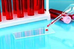 Emeoscania de sangre que cae por parásitos