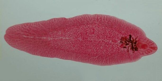 gusano trematodo en humanos